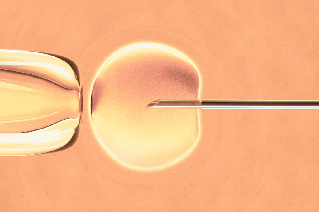 Restricting chubby women folk from IVF is discriminatory