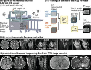 Total-physique magnetic resonance imaging at 0.05 Tesla | Science